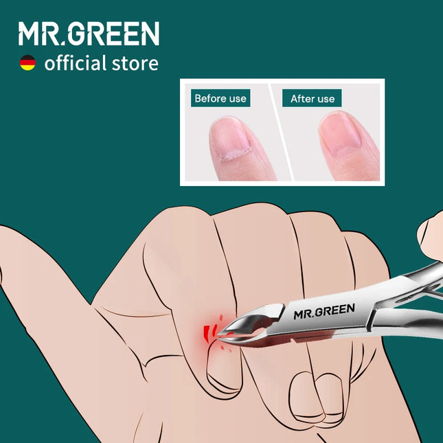 MR.GREEN Alicates para cutículas Cortaúñas Manicura Tijeras para cutículas Cortaúñas Removedor de piel muerta Pedicura Herramienta de corte de acero inoxidable