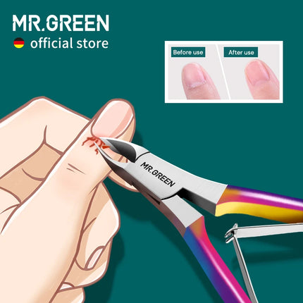 MR.GREEN Gorgeous Colorful Cuticle Nippers Cuticle Clippers Nail Manicure Scissors Trimmer Dead Skin Remover Stainless Stee Tool