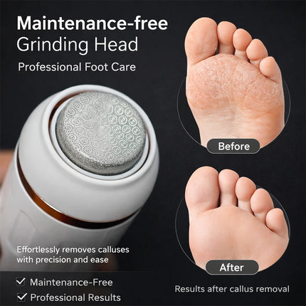 Electric Callus Remover Foot File Dry Skin Remover Dead Skin Eliminator Pedicure Exfoliator Tool for Home Foot Care 2026 New