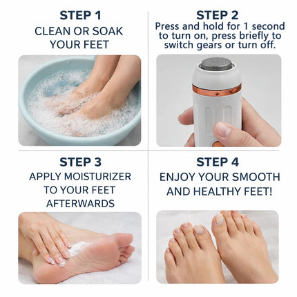 Electric Callus Remover Foot File Dry Skin Remover Dead Skin Eliminator Pedicure Exfoliator Tool for Home Foot Care 2026 New