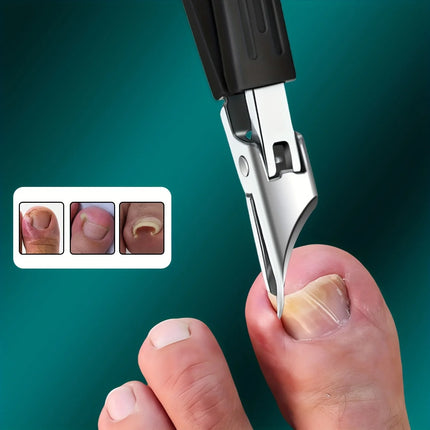 Thick Ingrown Nails Heavy Duty Stainless Steel Trimmer Safety Soft Grip Ultra Sharp 25 Degree Angled Blade Seniors - product