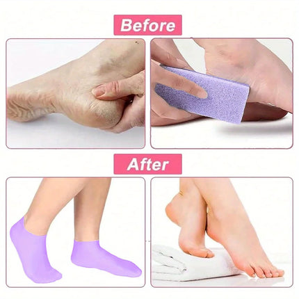 Moisturizing Foot Socks,silicone Socks For Dry Cracked Feet Women's Foot Socks For Moisturizing,featuring Massage - product i