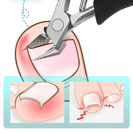 Sharp Toenail Ingrown Cuticle Nipper Nail Clipper Edge Cutter Scissor Nail Pliers Tool Dead Skin Remover Pedicure Manicure Tools